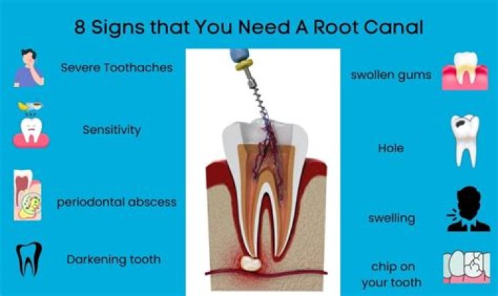 Can a root canal affect your sinuses?