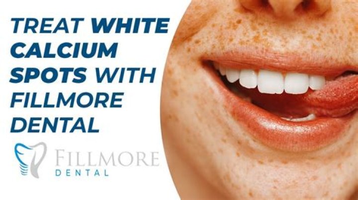 Can calcium spots be removed from teeth?