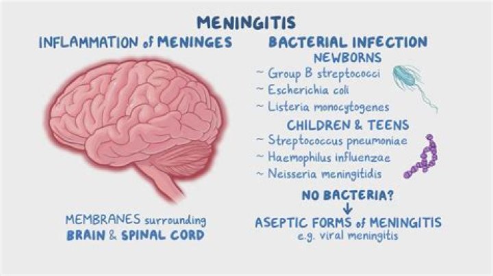 Can E coli cause meningitis?
