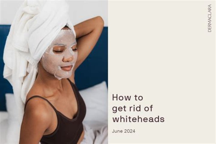 How do you get rid of deep Whiteheads?