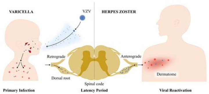 How does varicella zoster enter the body?