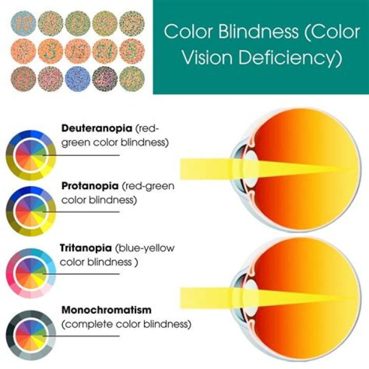 Is color blindness related to autism?