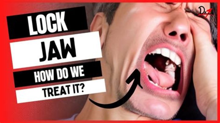 Should I go to the dentist for lockjaw?