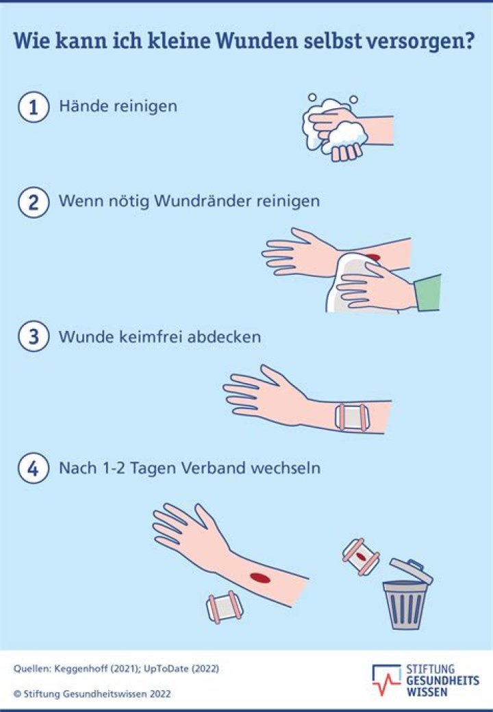 Warum wird eine SMS in eine MMS konvertiert?