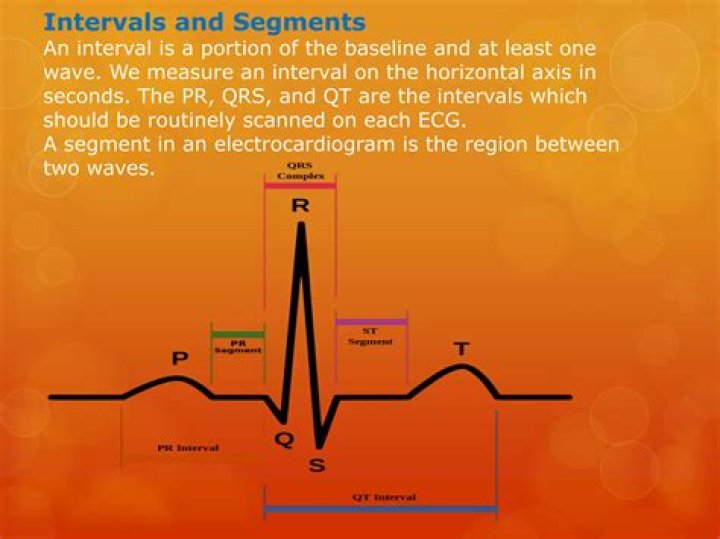 What are different waves intervals and segments of ECG?