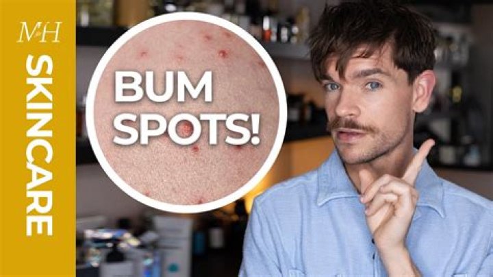 What causes a spotty bum?