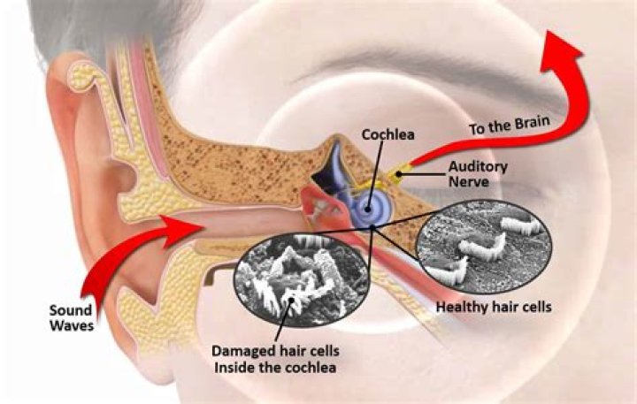 What causes noises in your ears?