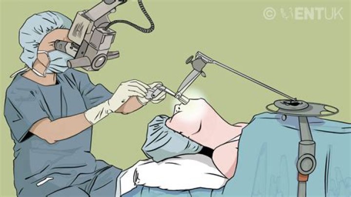 What is a Microlaryngoscopy?