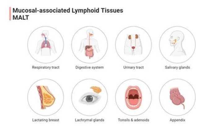 What is ectopic lymphoid tissue?