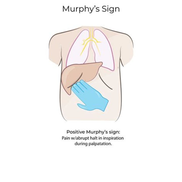 What is in Murphy NC?