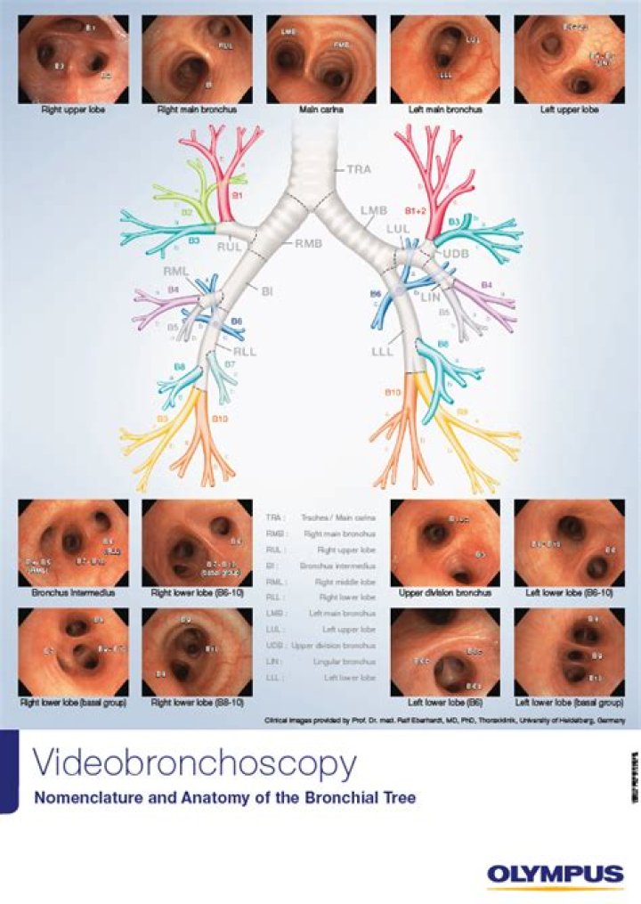 What is the job of the bronchial tubes?