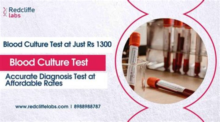 What is the purpose of a scaffold?