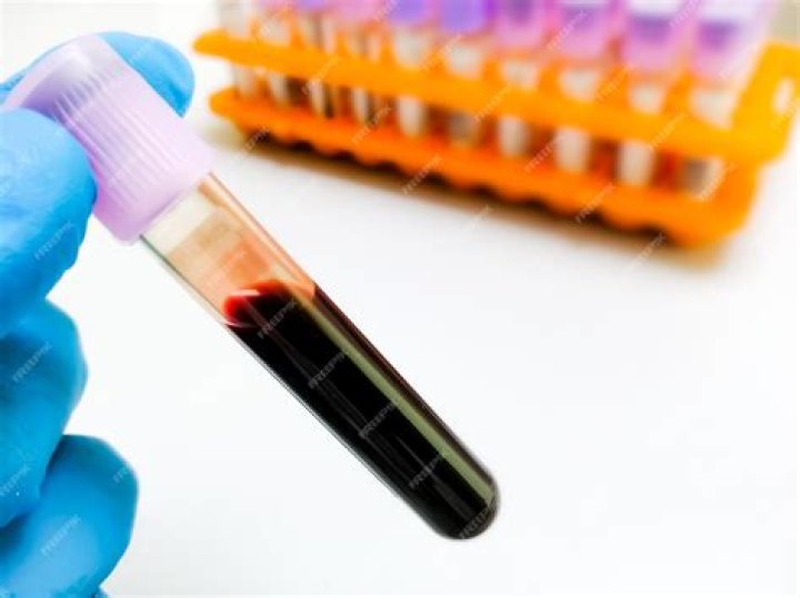 What tests are done on whole blood?