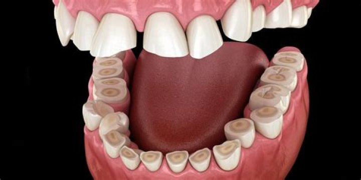 Why do I feel like I need to clench my teeth?